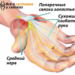 Sindrom-zapjastnogo-kanala-simptomy-300x300 Синдром запястного канала